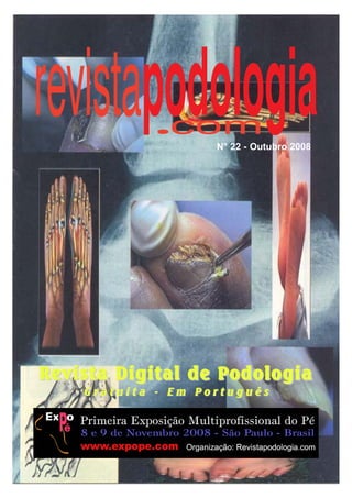 N° 22 - Outubro 2008 
Revista Digital de Podologia 
G r a t u i t a - Em P o r t u g u ê s 
 