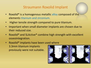 Recent advances in implants.