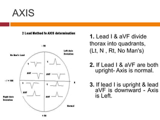 Ecg interpritation | PPTX