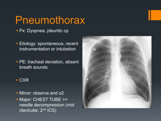 Pneumothorax
 Px: Dyspnea, pleuritic cp
 Etiology: spontaneous, recent
instrumentation or intubation
 PE: tracheal deviation, absent
breath sounds
 CXR
 Minor: observe and o2
 Major: CHEST TUBE >>
needle decompression (mid
clavicular, 2nd ICS)
 