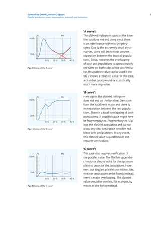 5Sysmex Xtra Online | June 2011 | 6 pages
Platelet distribution curves: interpretation, potentials and limitations
‘A curve’:
The platelet histogram starts at the base-
line but does not end there since there
is an interference with microerythro-
cytes. Due to the extremely small eryth-
rocytes, there will be no clear volume
separation between the two cell popula-
tions. Since, however, the overlapping
of both cell populations is approximately
the same on both sides of the discrimina-
tor, this platelet value can be used if the
MCV shows a standard value. In this case,
a chamber count would be statistically
much more imprecise.
‘B curve’:
Here again, the platelet histogram
does not end on the baseline. Deviation
from the baseline is major and there is
no separation between the two popula-
tions. There is a total overlapping of both
populations. A possible cause might here
be fragmentocytes. Fragmentocytes ‘slip’
into the platelet population and do not
allow any clear separation between red
blood cells and platelets. In any event,
this platelet value is questionable and
requires verification.
‘C curve’:
This case also requires verification of
the platelet value. The flexible upper dis-
criminator always looks for the optimum
place to separate the populations. How-
ever, due to giant platelets or micro-clots,
no clear separation can be found; instead,
there is major overlapping. The platelet
value should be verified, for example, by
means of the Fonio method.
Fig. 6 Display of the ‘A curve’
10 fL 20 fL 30 fL 40 fL
20%
PUPL
100%
Fig. 7 Display of the ‘B curve’
10 fL 20 fL 30 fL 40 fL
20%
PUPL
100%
Fig. 8 Display of the ‘C curve’
10 fL 20 fL 30 fL 40 fL
20%
PUPL
100%
 