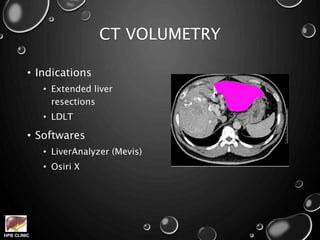 HPB CLINIC
CT VOLUMETRY
• Indications
• Extended liver
resections
• LDLT
• Softwares
• LiverAnalyzer (Mevis)
• Osiri X
 