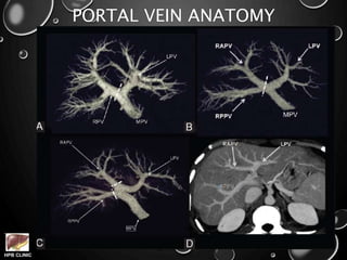 HPB CLINIC
PORTAL VEIN ANATOMY
 