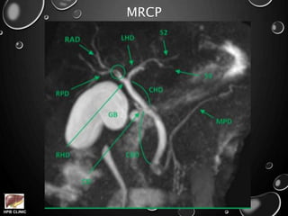 HPB CLINIC
MRCP
 
