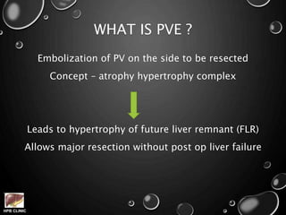 HPB CLINIC
WHAT IS PVE ?
Embolization of PV on the side to be resected
Concept – atrophy hypertrophy complex
Leads to hypertrophy of future liver remnant (FLR)
Allows major resection without post op liver failure
 