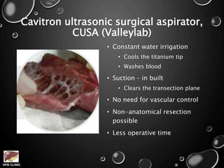 HPB CLINIC
Cavitron ultrasonic surgical aspirator,
CUSA (Valleylab)
• Constant water irrigation
• Cools the titanium tip
• Washes blood
• Suction – in built
• Clears the transection plane
• No need for vascular control
• Non-anatomical resection
possible
• Less operative time
 