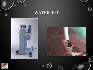 HPB CLINIC
WATER-JET
 