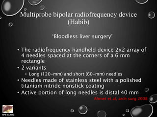 HPB CLINIC
Multiprobe bipolar radiofrequency device
(Habib)
‘Bloodless liver surgery’
• The radiofrequency handheld device 2x2 array of
4 needles spaced at the corners of a 6 mm
rectangle
• 2 variants
• Long (120-mm) and short (60-mm) needles
• Needles made of stainless steel with a polished
titanium nitride nonstick coating
• Active portion of long needles is distal 40 mm
Ahmet et al, arch surg 2008
 