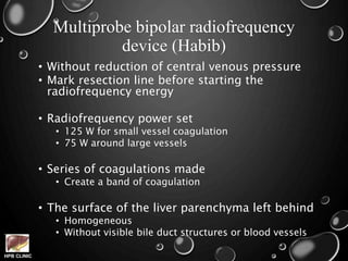 HPB CLINIC
Multiprobe bipolar radiofrequency
device (Habib)
• Without reduction of central venous pressure
• Mark resection line before starting the
radiofrequency energy
• Radiofrequency power set
• 125 W for small vessel coagulation
• 75 W around large vessels
• Series of coagulations made
• Create a band of coagulation
• The surface of the liver parenchyma left behind
• Homogeneous
• Without visible bile duct structures or blood vessels
 