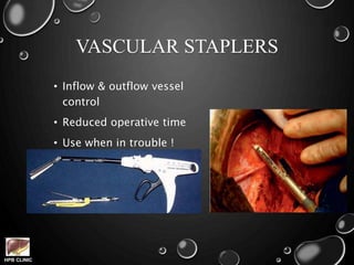 HPB CLINIC
VASCULAR STAPLERS
• Inflow & outflow vessel
control
• Reduced operative time
• Use when in trouble !
 