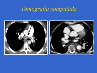 Tomografía computada

 