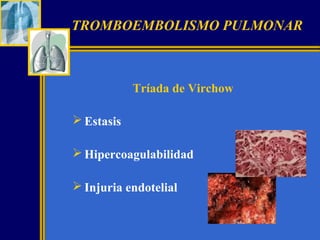 TROMBOEMBOLISMO PULMONAR

Tríada de Virchow
 Estasis
 Hipercoagulabilidad
 Injuria endotelial

 