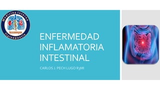 ENFERMEDAD
INFLAMATORIA
INTESTINAL
CARLOS J. PECH LUGO R3MI
 