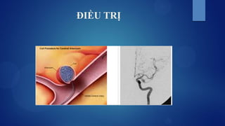 ĐIỀU TRỊ
 