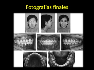 Fotografías finales
 