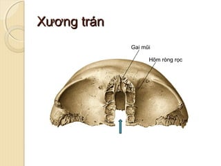 XƯƠNG ĐẦU MẶT | PPT