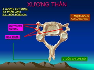XƯƠNG THÂN
4- XƯƠNG CỘT SỐNG:
4.2- PHÂN LOẠI:
4.2.1- ĐỐT SỐNG CỔ:
ĐẶC ĐIỂM:
1- MÕM NGANG
CÓ LỖ NGANG
2- MÕM GAI CHẺ ĐÔI
CỦ TRƯỚC
CỦ SAU
 
