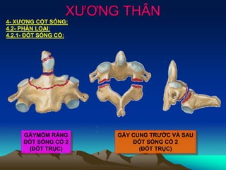 XƯƠNG THÂN
4- XƯƠNG CỘT SỐNG:
4.2- PHÂN LOẠI:
4.2.1- ĐỐT SỐNG CỔ:
GÃY CUNG TRƯỚC VÀ SAU
ĐỐT SỐNG CỔ 2
(ĐỐT TRỤC)
GÃYMÕM RĂNG
ĐỐT SỐNG CỔ 2
(ĐỐT TRỤC)
 
