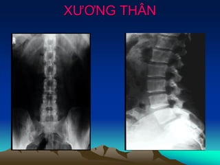 XƯƠNG THÂN
 