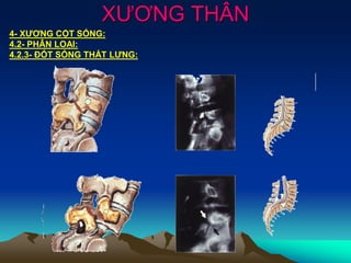 XƯƠNG THÂN
4- XƯƠNG CỘT SỐNG:
4.2- PHÂN LOẠI:
4.2.3- ĐỐT SỐNG THẮT LƯNG:
 