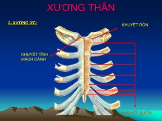 XƯƠNG THÂN
2- XƯƠNG ỨC:
KHUYẾT TĨNH
MẠCH CẢNH
KHUYẾT ĐÒN
KHUYẾT SƯỜN
 