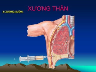 XƯƠNG THÂN3- XƯƠNG SƯỜN:
 