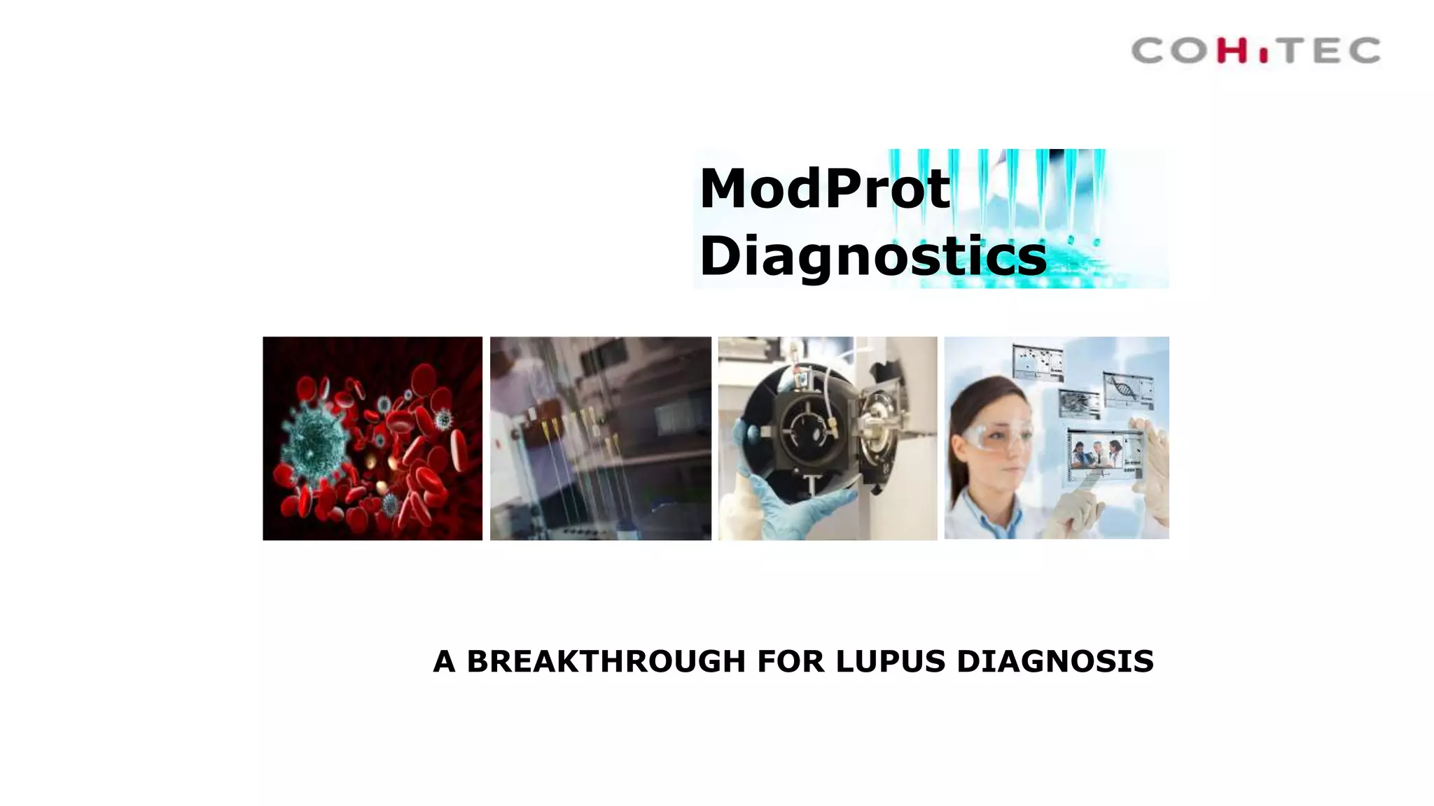 A BREAKTHROUGH FOR LUPUS DIAGNOSIS
ModProt
Diagnostics
 