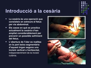 Introducció a la cesària <ul><li>La cesària és una operació que consisteix en extreure el fetus per via abdominal. </li></...
