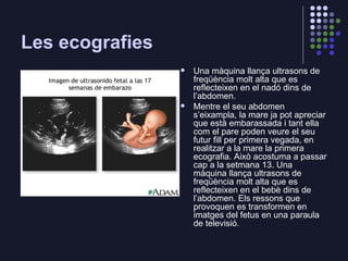 Les ecografies <ul><li>Una màquina llança ultrasons de freqüència molt alta que es reflecteixen en el  nadó  dins de l’abd...