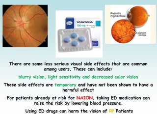 There are some less serious visual side effects that are common
among users. These can include:
blurry vision, light sensitivity and decreased color vision
These side effects are temporary and have not been shown to have a
harmful effect
For patients already at risk for NAION, taking ED medication can
raise the risk by lowering blood pressure.
Using ED drugs can harm the vision of RP Patients
 
