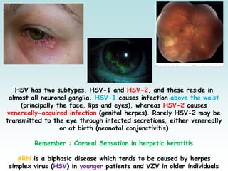 HSV has two subtypes, HSV-1 and HSV-2, and these reside in
almost all neuronal ganglia. HSV-1 causes infection above the waist
(principally the face, lips and eyes), whereas HSV-2 causes
venereally-acquired infection (genital herpes). Rarely HSV-2 may be
transmitted to the eye through infected secretions, either venereally
or at birth (neonatal conjunctivitis)
Remember : Corneal Sensation in herpetic keratitis
ARN is a biphasic disease which tends to be caused by herpes
simplex virus (HSV) in younger patients and VZV in older individuals
 