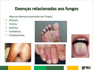 Doenças relacionadas aos fungos
Algumas doenças provocadas por fungos:
• Micoses;
• Frieiras;
• Sapinho;
• Candidíase;
• Histoplasmose.
 