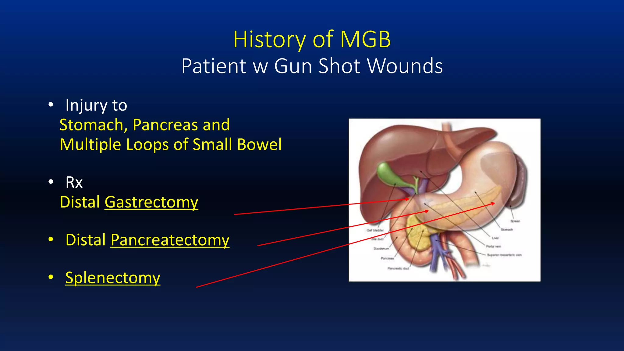 Dr Rutledge Introduction & Background Mini-Gastric Bypass | PPTX