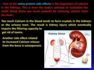 Too much Calcium in the blood tends to form crystals in the kidneys
or the urinary tract. The result is kidney injury which eventually
impairs the filtering capacity to
get rid of toxins.
- One of the whey protein side effects is the deposition of calcium
in the kidneys. This is from the body’s attempt to neutralize the
acidic blood (from too much protein) by releasing calcium from
the bone.
Another side effect related
to increased Calcium release
from the bone is osteoporosis
 