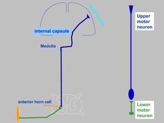 Medulla
internal capsule
Upper
motor
neuron
Lower
motor
neuron
anterior horn cell
 