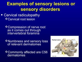 Examples of sensory lesions or
sensory disorders
• Cervical radiculopathy
Cervical root lesion
Compression of nerve root
as it comes out through
intervertebral foramina
Numbness and sensory loss
of relevant dermatomes
Commonly affected are C56
dermatomes
 