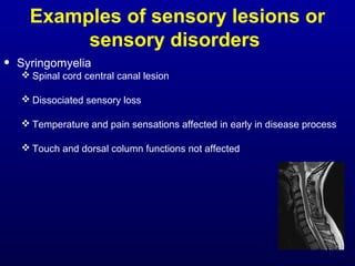 Examples of sensory lesions or
sensory disorders
• Syringomyelia
 Spinal cord central canal lesion
 Dissociated sensory loss
 Temperature and pain sensations affected in early in disease process
 Touch and dorsal column functions not affected
 
