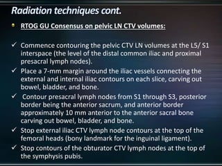 RTOG GU Consensus on pelvic LN CTV volumes:
 Commence contouring the pelvic CTV LN volumes at the L5/ S1
interspace (the level of the distal common iliac and proximal
presacral lymph nodes).
 Place a 7-mm margin around the iliac vessels connecting the
external and internal iliac contours on each slice, carving out
bowel, bladder, and bone.
 Contour presacral lymph nodes from S1 through S3, posterior
border being the anterior sacrum, and anterior border
approximately 10 mm anterior to the anterior sacral bone
carving out bowel, bladder, and bone.
 Stop external iliac CTV lymph node contours at the top of the
femoral heads (bony landmark for the inguinal ligament).
 Stop contours of the obturator CTV lymph nodes at the top of
the symphysis pubis.
 