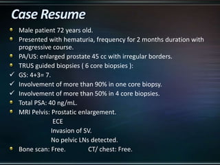 Male patient 72 years old.
Presented with hematuria, frequency for 2 months duration with
progressive course.
PA/US: enlarged prostate 45 cc with irregular borders.
TRUS guided biopsies ( 6 core biopsies ):
 GS: 4+3= 7.
 Involvement of more than 90% in one core biopsy.
 Involvement of more than 50% in 4 core biopsies.
Total PSA: 40 ng/mL.
MRI Pelvis: Prostatic enlargement.
ECE
Invasion of SV.
No pelvic LNs detected.
Bone scan: Free. CT/ chest: Free.
 