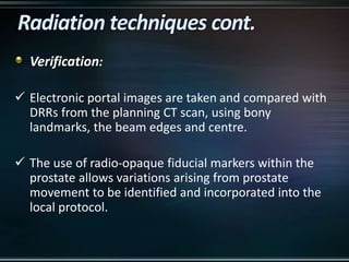 Verification:
 Electronic portal images are taken and compared with
DRRs from the planning CT scan, using bony
landmarks, the beam edges and centre.
 The use of radio-opaque fiducial markers within the
prostate allows variations arising from prostate
movement to be identified and incorporated into the
local protocol.
 