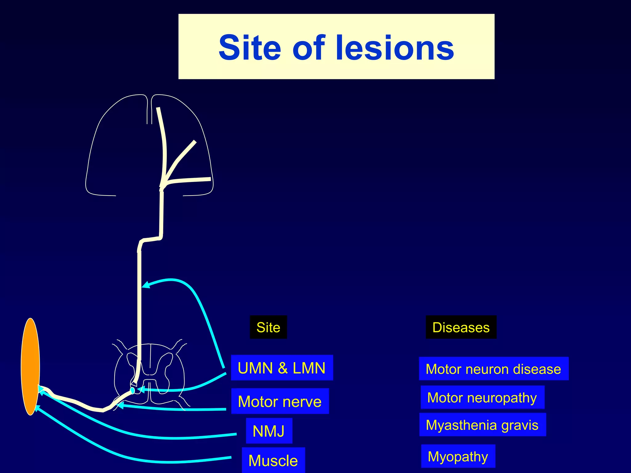 Site of lesions
UMN & LMN
Motor nerve
NMJ
Muscle
Motor neuron disease
Diseases
Motor neuropathy
Myasthenia gravis
Myopathy
Site
 