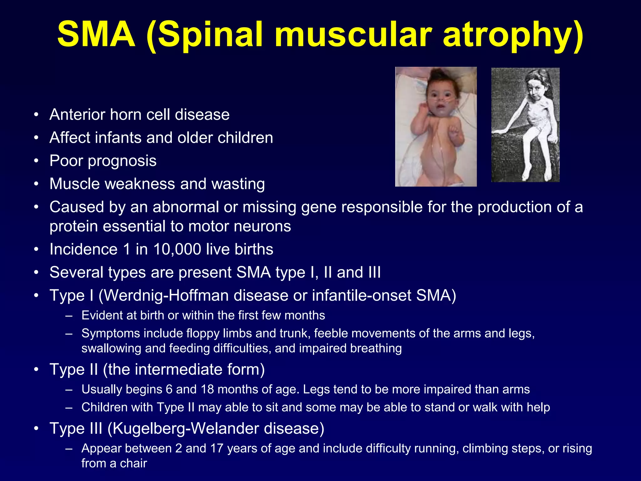 SMA (Spinal muscular atrophy)
• Anterior horn cell disease
• Affect infants and older children
• Poor prognosis
• Muscle weakness and wasting
• Caused by an abnormal or missing gene responsible for the production of a
protein essential to motor neurons
• Incidence 1 in 10,000 live births
• Several types are present SMA type I, II and III
• Type I (Werdnig-Hoffman disease or infantile-onset SMA)
– Evident at birth or within the first few months
– Symptoms include floppy limbs and trunk, feeble movements of the arms and legs,
swallowing and feeding difficulties, and impaired breathing
• Type II (the intermediate form)
– Usually begins 6 and 18 months of age. Legs tend to be more impaired than arms
– Children with Type II may able to sit and some may be able to stand or walk with help
• Type III (Kugelberg-Welander disease)
– Appear between 2 and 17 years of age and include difficulty running, climbing steps, or rising
from a chair
 