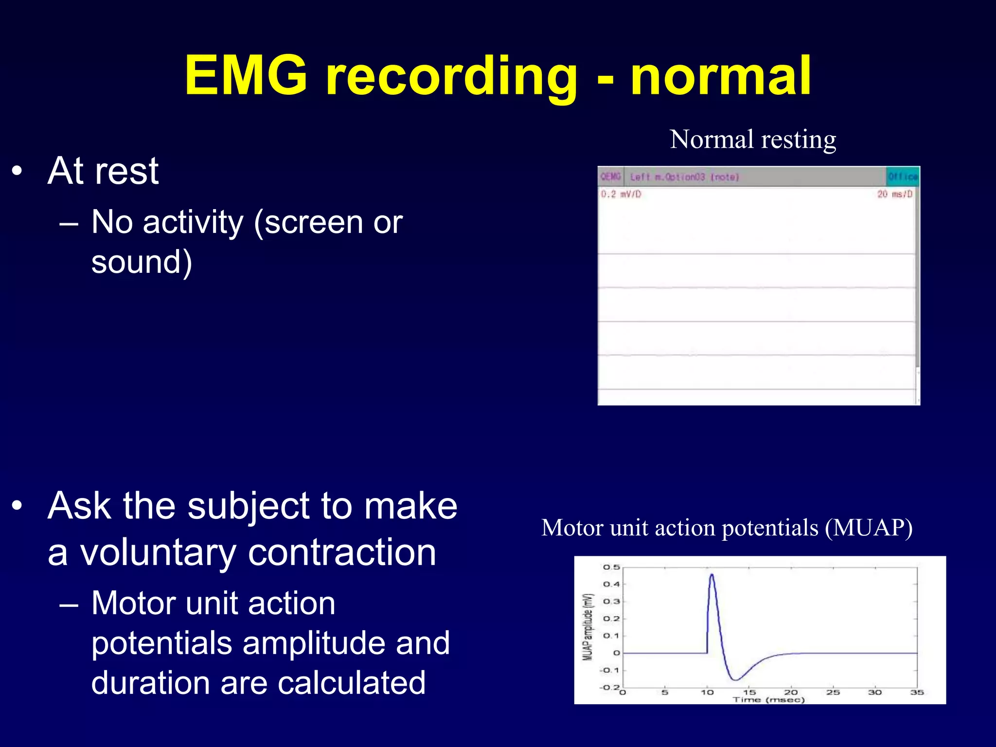 EMG recording - normal
• At rest
– No activity (screen or
sound)
• Ask the subject to make
a voluntary contraction
– Motor unit action
potentials amplitude and
duration are calculated
Normal resting
Motor unit action potentials (MUAP)
 