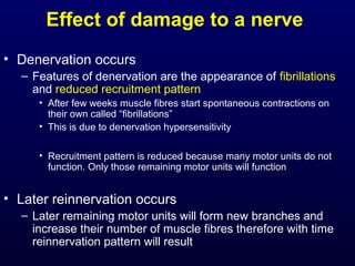 Effect of damage to a nerve
• Denervation occurs
  – Features of denervation are the appearance of fibrillations
    and reduced recruitment pattern
     • After few weeks muscle fibres start spontaneous contractions on
       their own called “fibrillations”
     • This is due to denervation hypersensitivity

     • Recruitment pattern is reduced because many motor units do not
       function. Only those remaining motor units will function


• Later reinnervation occurs
  – Later remaining motor units will form new branches and
    increase their number of muscle fibres therefore with time
    reinnervation pattern will result
 