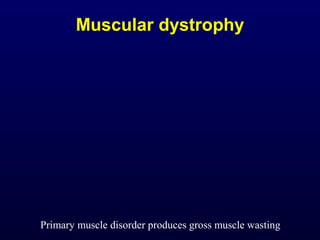 Muscular dystrophy




Primary muscle disorder produces gross muscle wasting
 