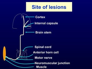 Site of lesions
 Cortex

 Internal capsule


 Brain stem



 Spinal cord
Anterior horn cell
 Motor nerve
 Neuromuscular junction
  Muscle
 