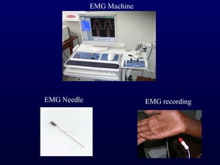 EMG Machine




EMG Needle                 EMG recording
 