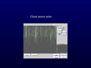 Giant motor units
 