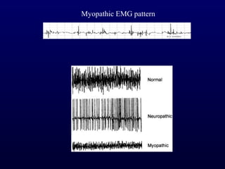 Myopathic EMG pattern
 