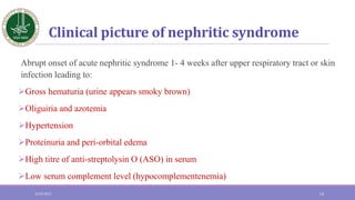 Clinical picture of nephritic syndrome
Abrupt onset of acute nephritic syndrome 1- 4 weeks after upper respiratory tract o...